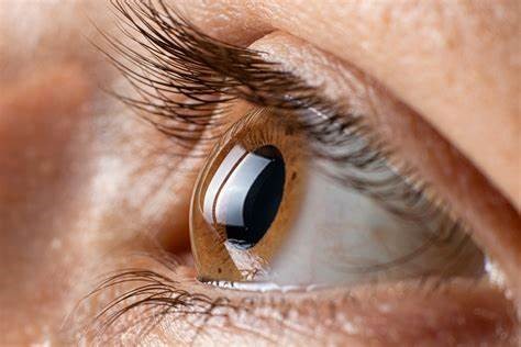 Keratoconus Clinic