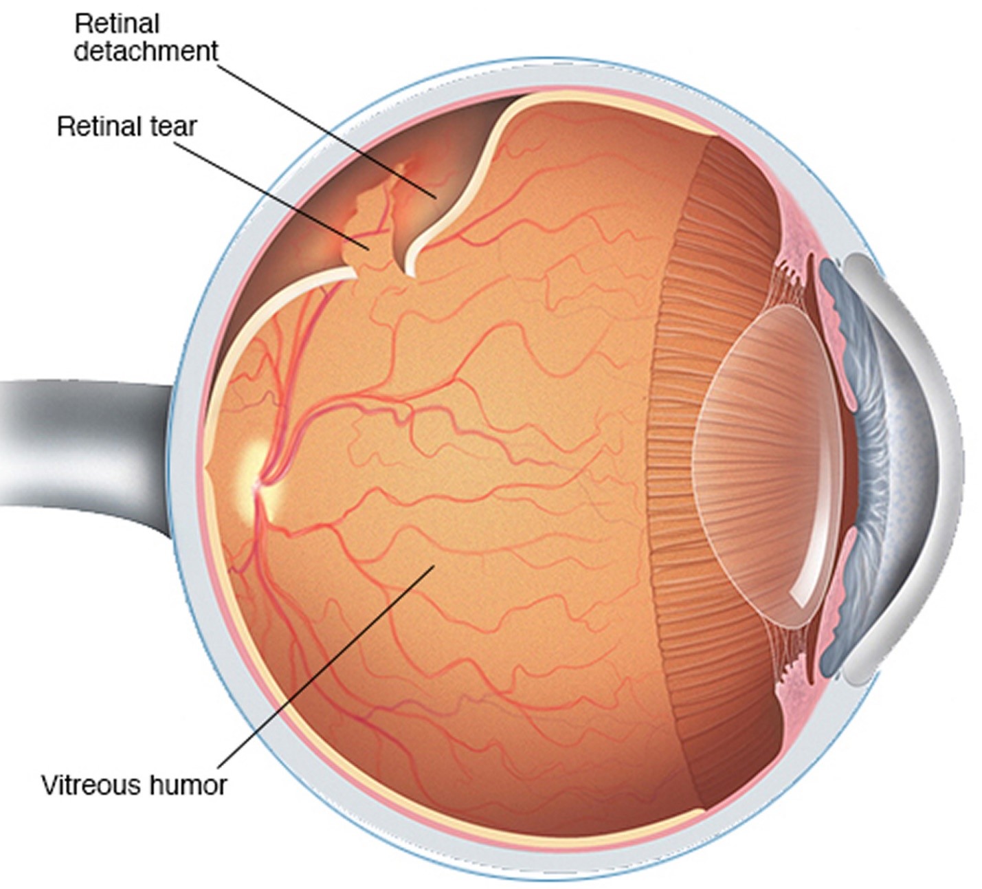 Retina services