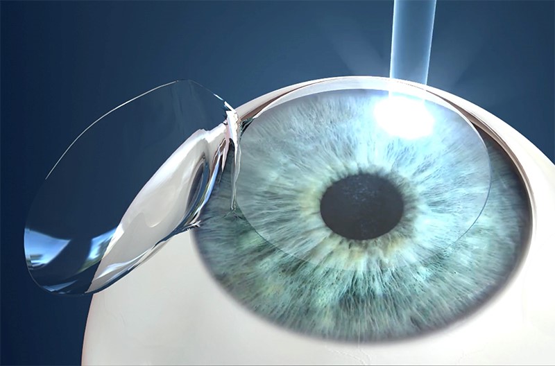Services kiran eye hospital