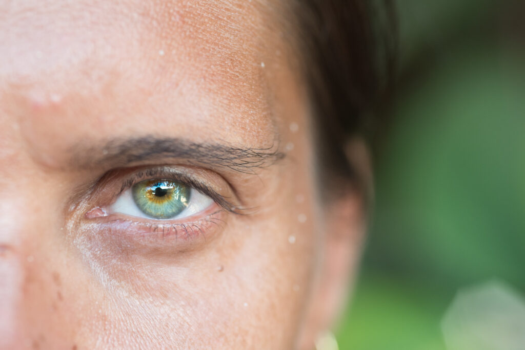 Cataract Surgery in Bangalore