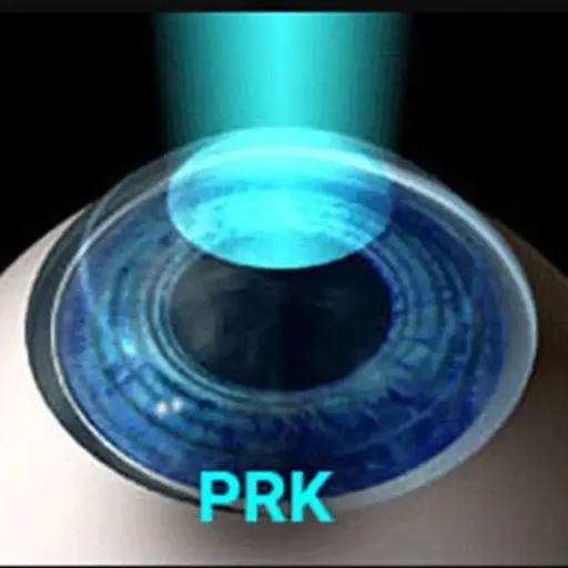 prk-1 prk-1